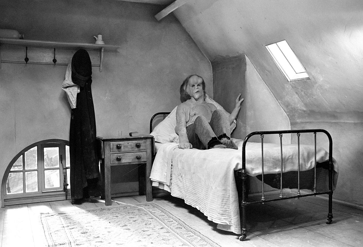 Der Elefantenmensch - Film-Still