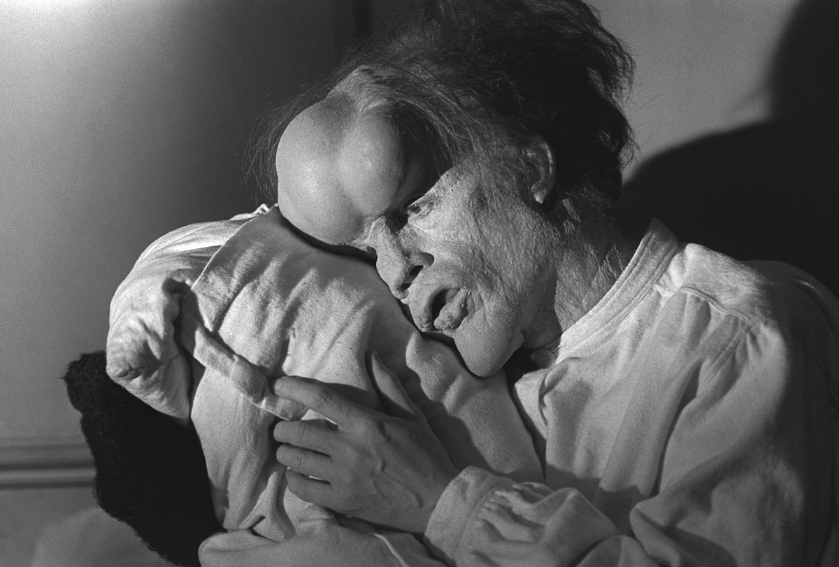 Der Elefantenmensch - Film-Still